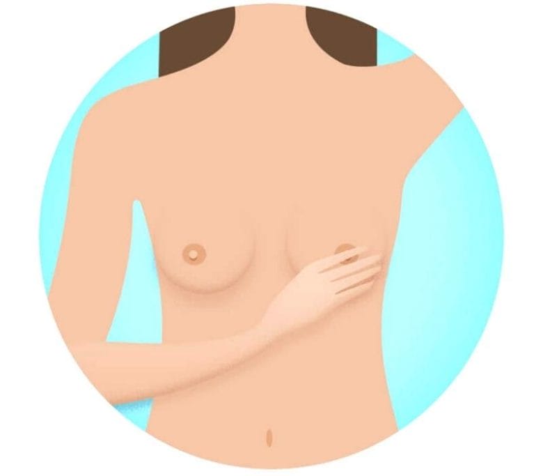 تغيير في شكل الثدي أو الحلمة من أول علامات سرطان الثدي ظهوراً